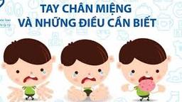 BÀI TUYÊN TRUYỀN PHÒNG CHỐNG BỆNH TAY CHÂN MIỆNG