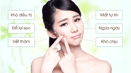 CHĂM SÓC SỨC KHỎE CHO TUỔI DẬY THÌ