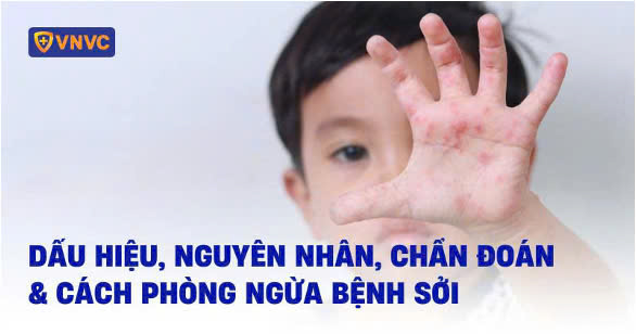 Lớp 8A1 tuyên truyền về bệnh sởi và các biện pháp phòng tránh